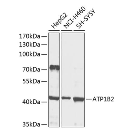 Western Blot - Anti-ATP1B2 Antibody (A16373) - Antibodies.com
