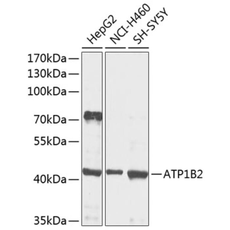 Western Blot - Anti-ATP1B2 Antibody (A16373) - Antibodies.com