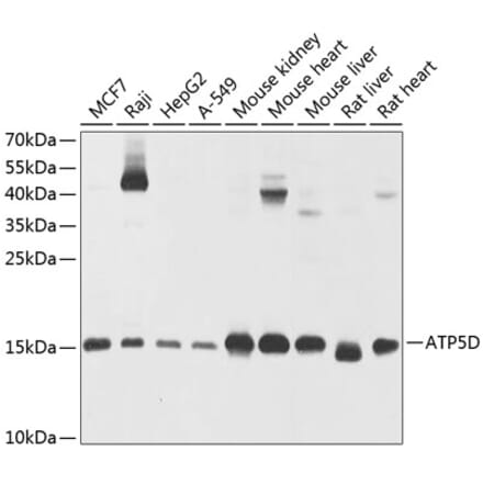Western Blot - Anti-ATP5D Antibody (A16374) - Antibodies.com