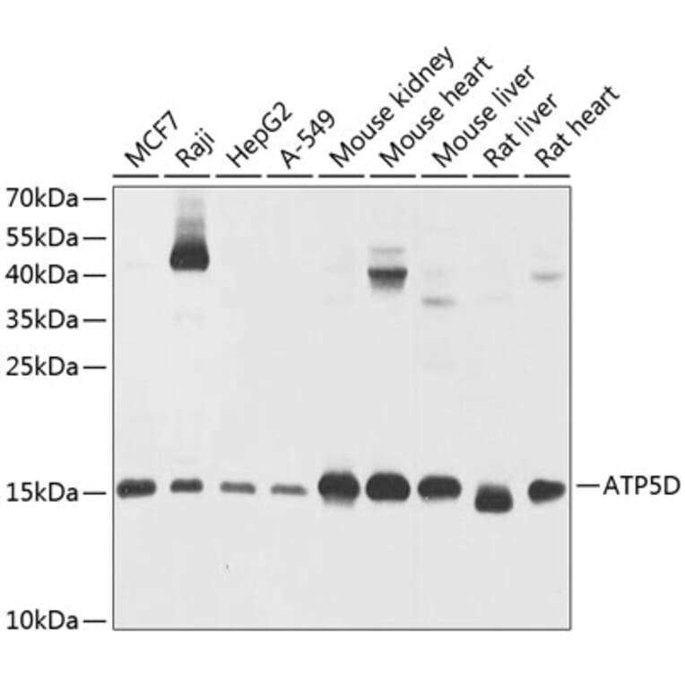 Western Blot - Anti-ATP5D Antibody (A16374) - Antibodies.com