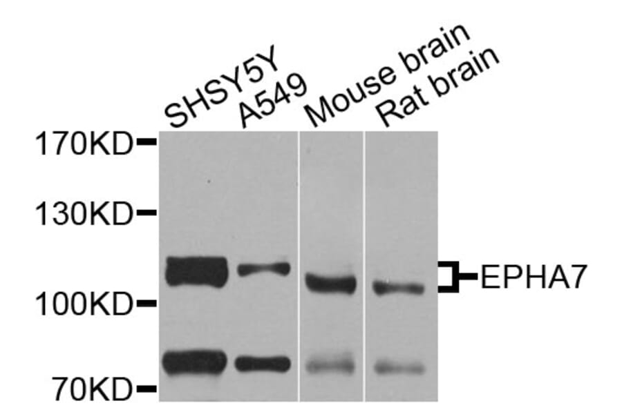 Western Blot - Anti-EPHA7 Antibody (A9931) - Antibodies.com