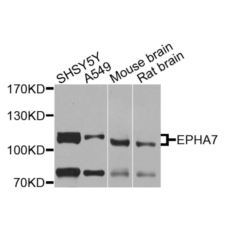 Western Blot - Anti-EPHA7 Antibody (A9931) - Antibodies.com