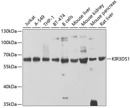 Western blot analysis of extracts of various cell lines, using Anti-KIR3DS1 Antibody (A9936) at 1:1,000 dilution.
Secondary antibody: Goat Anti-Rabbit IgG (H+L) (HRP) (AS014) at 1:10,000 dilution.
Lysates / proteins: 25µg per lane.
Blocking buffer: 3% non-fat dry milk in TBST.
Detection: ECL Basic Kit (RM00020).
Exposure time: 60s.