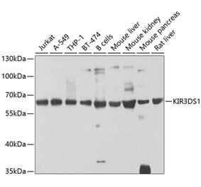 Western Blot - Anti-KIR3DS1 Antibody (A16377) - Antibodies.com