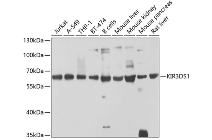 Western Blot - Anti-KIR3DS1 Antibody (A16377) - Antibodies.com