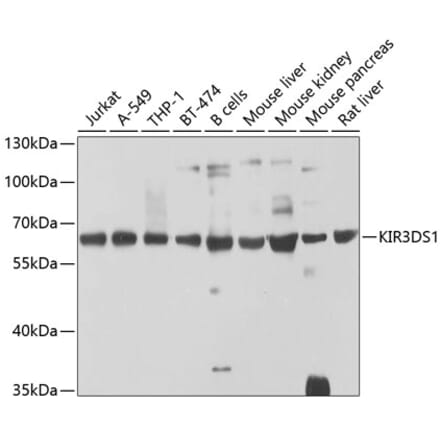 Western Blot - Anti-KIR3DS1 Antibody (A16377) - Antibodies.com