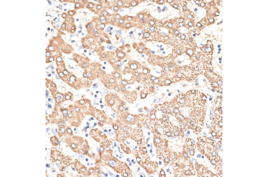 Immunohistochemistry - Anti-KIR3DS1 Antibody (A16377) - Antibodies.com
