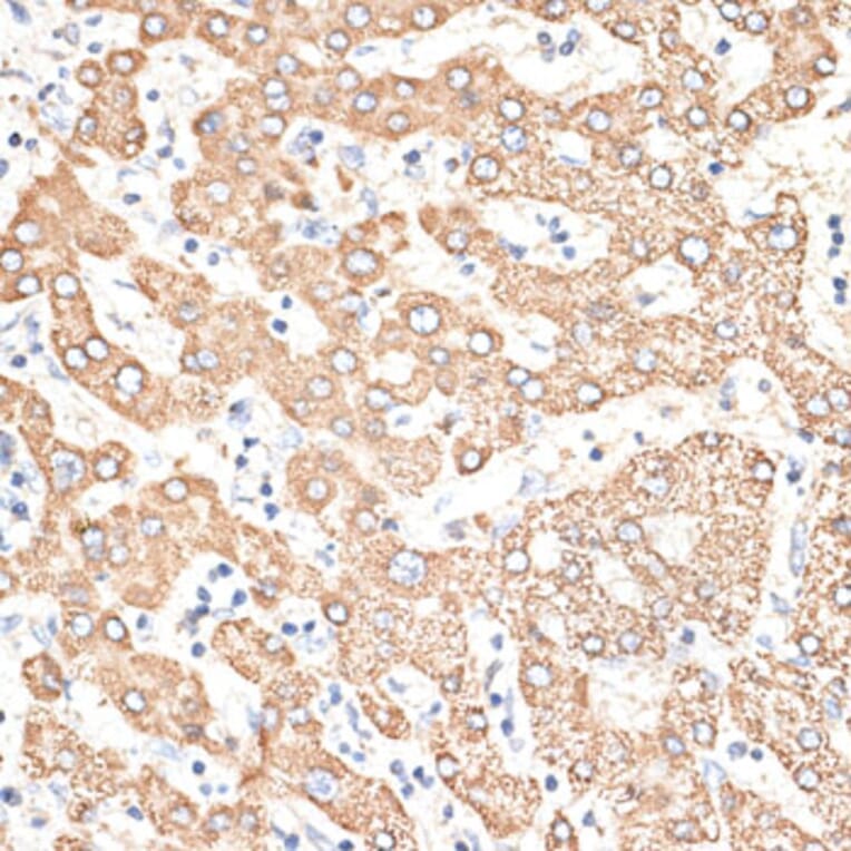 Immunohistochemistry - Anti-KIR3DS1 Antibody (A16377) - Antibodies.com