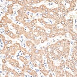 Immunohistochemistry - Anti-KIR3DS1 Antibody (A16377) - Antibodies.com