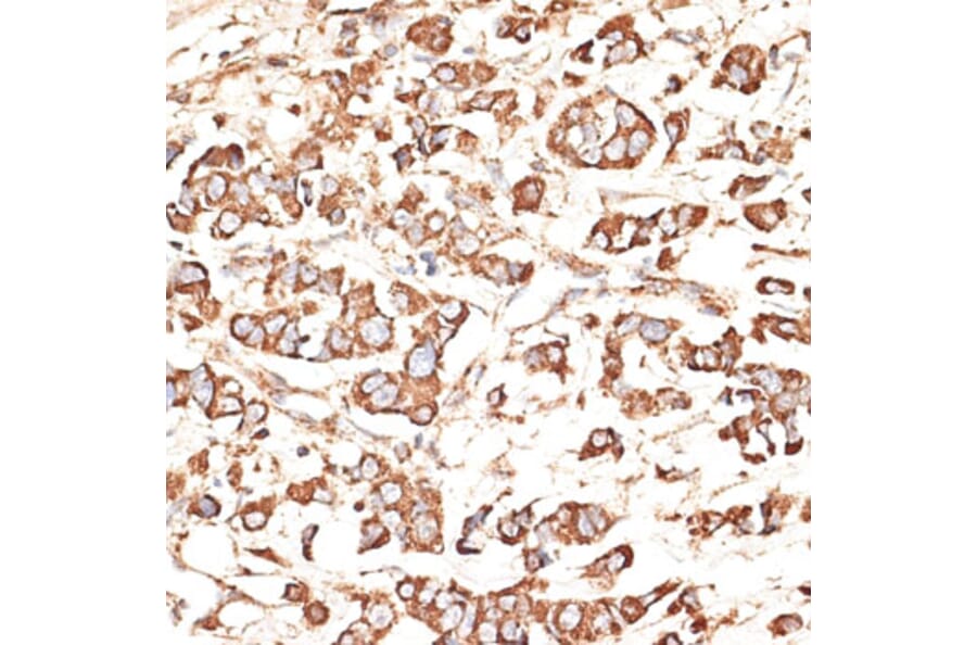 Immunohistochemistry - Anti-KIR3DS1 Antibody (A16377) - Antibodies.com