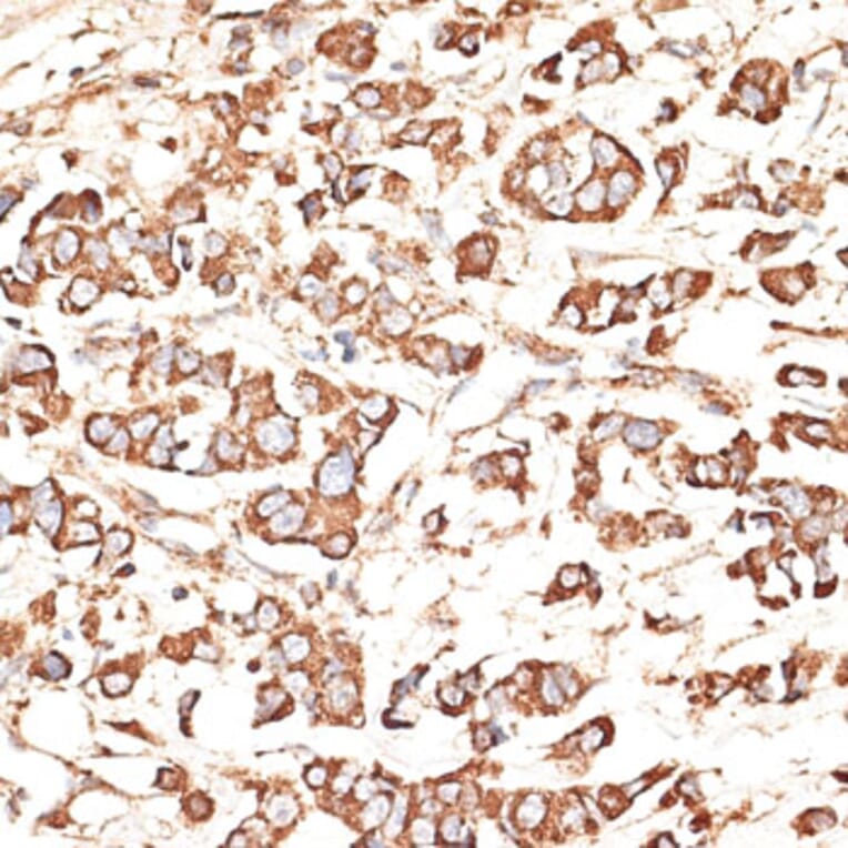 Immunohistochemistry - Anti-KIR3DS1 Antibody (A16377) - Antibodies.com