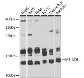 Western Blot - Anti-MT-ND3 Antibody (A16378) - Antibodies.com
