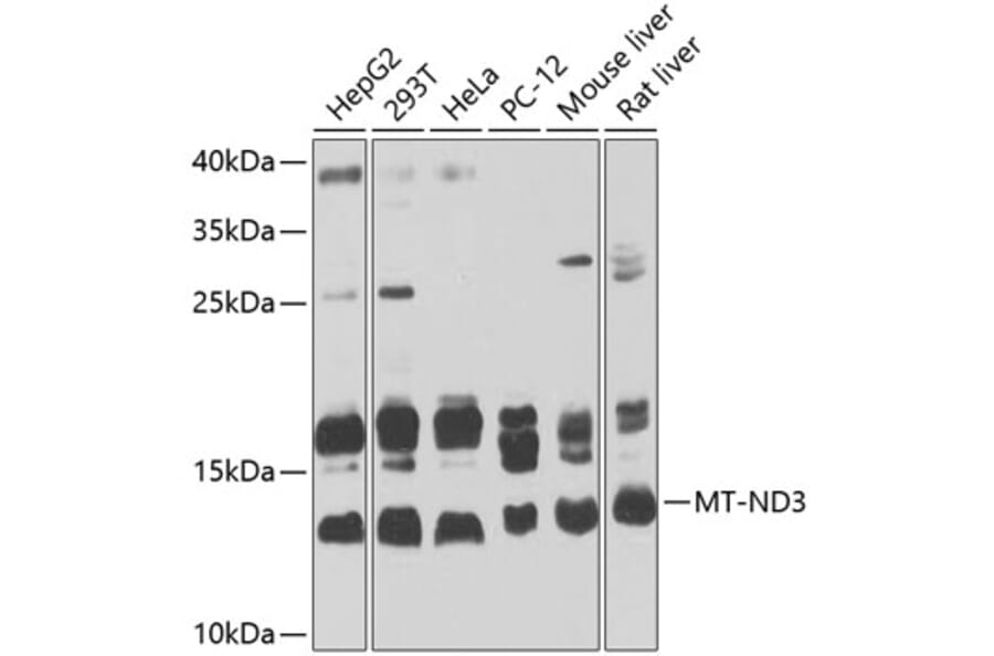 Western Blot - Anti-MT-ND3 Antibody (A16378) - Antibodies.com