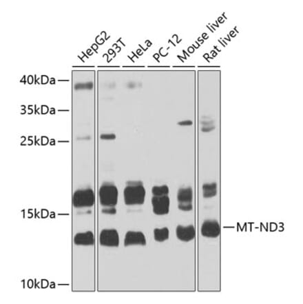 Western Blot - Anti-MT-ND3 Antibody (A16378) - Antibodies.com