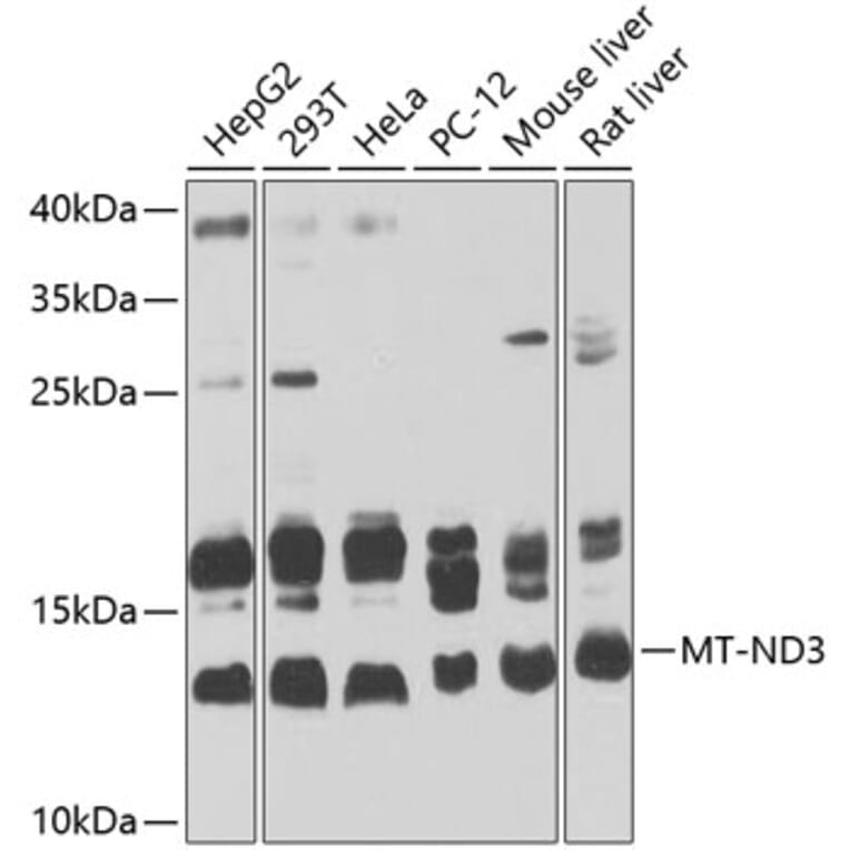 Western Blot - Anti-MT-ND3 Antibody (A16378) - Antibodies.com