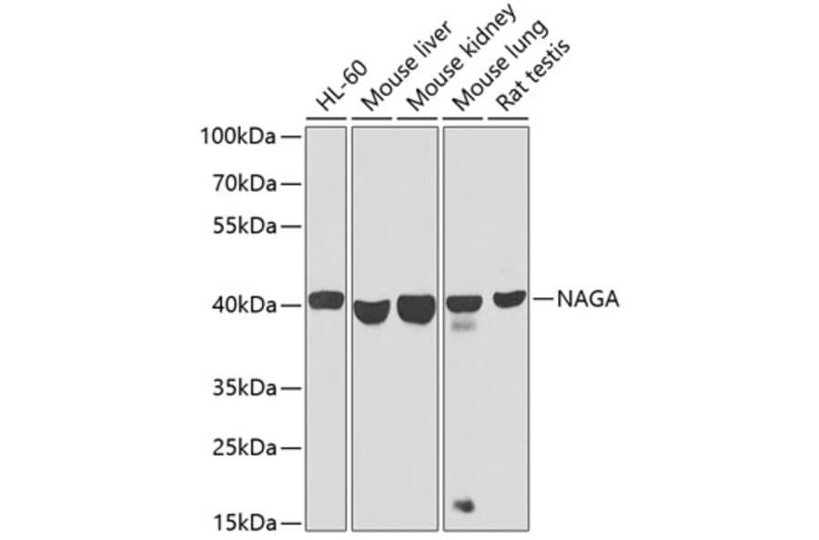 Western Blot - Anti-NAGA Antibody (A16379) - Antibodies.com