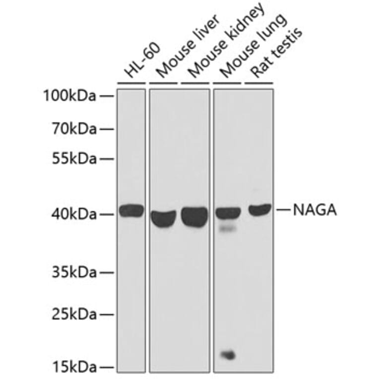 Western Blot - Anti-NAGA Antibody (A16379) - Antibodies.com