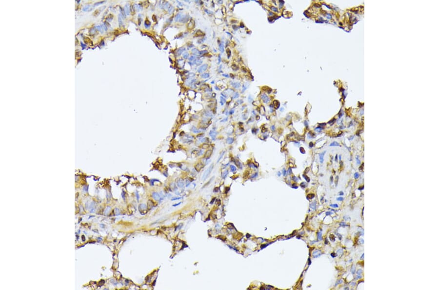Immunohistochemistry - Anti-Proteasome 20S beta 3 Antibody (A16380) - Antibodies.com