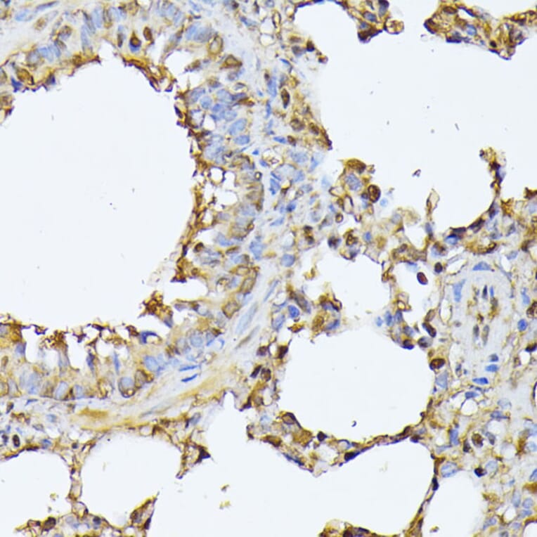 Immunohistochemistry - Anti-Proteasome 20S beta 3 Antibody (A16380) - Antibodies.com
