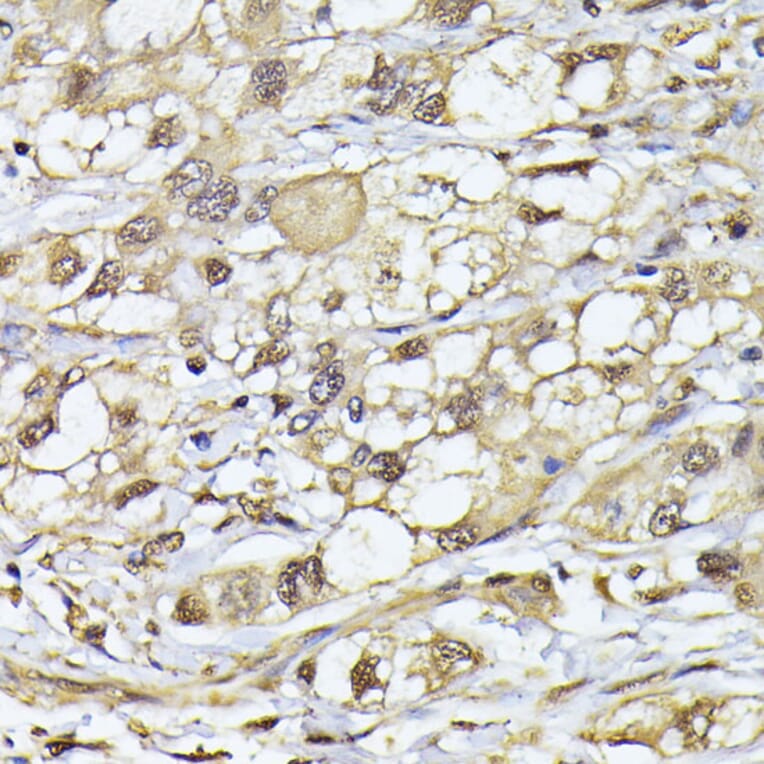 Immunohistochemistry - Anti-Proteasome 20S beta 3 Antibody (A16380) - Antibodies.com