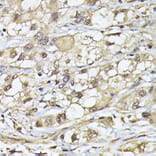 Immunohistochemistry - Anti-Proteasome 20S beta 3 Antibody (A16380) - Antibodies.com