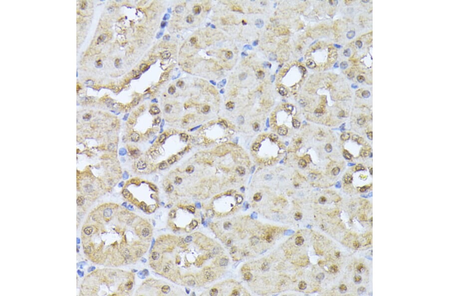 Immunohistochemistry - Anti-Proteasome 20S beta 3 Antibody (A16380) - Antibodies.com
