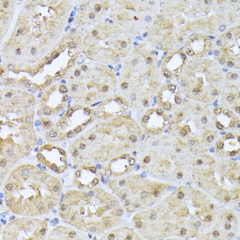 Immunohistochemistry - Anti-Proteasome 20S beta 3 Antibody (A16380) - Antibodies.com