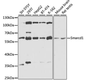 Western Blot - Anti-SMARCD1 Antibody (A16381) - Antibodies.com