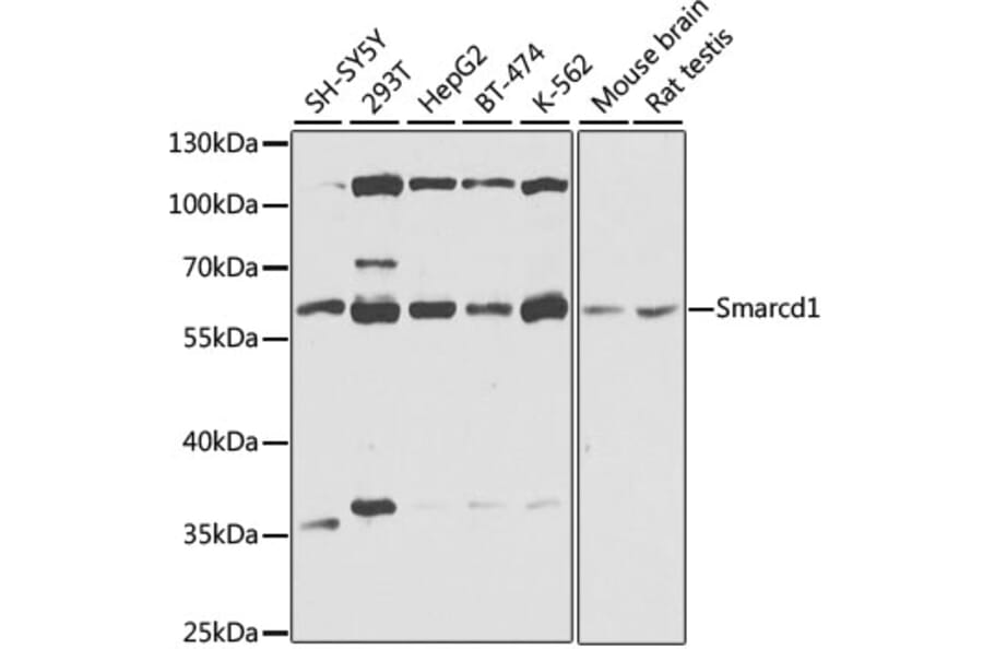Western Blot - Anti-SMARCD1 Antibody (A16381) - Antibodies.com