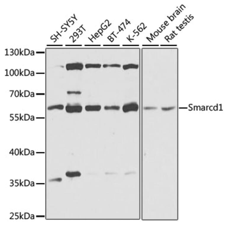 Western Blot - Anti-SMARCD1 Antibody (A16381) - Antibodies.com