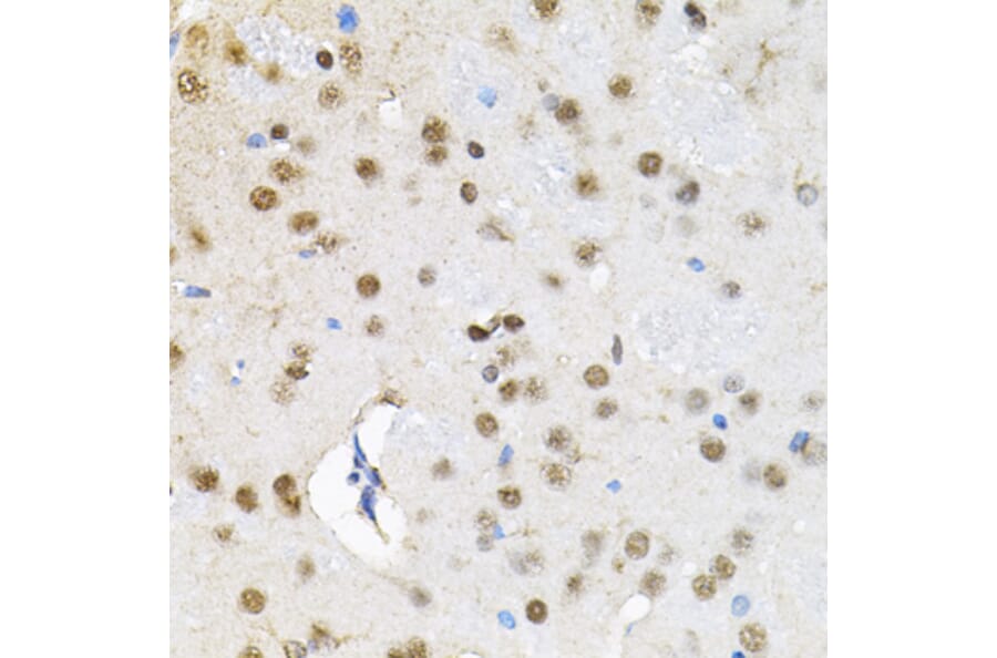 Immunohistochemistry - Anti-SMARCD1 Antibody (A16381) - Antibodies.com