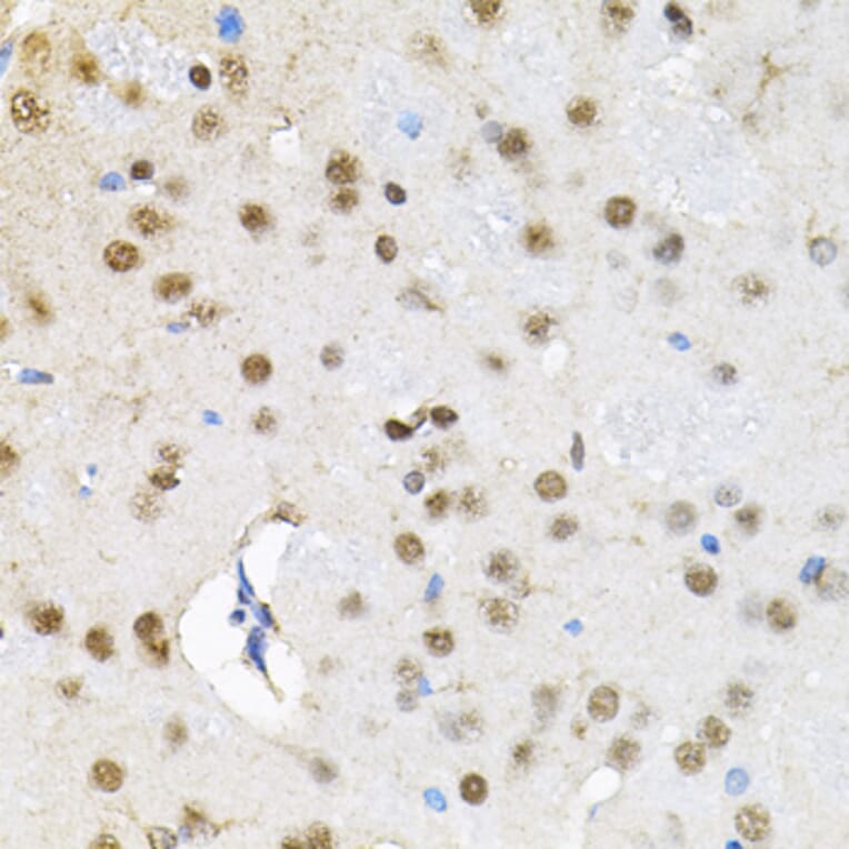 Immunohistochemistry - Anti-SMARCD1 Antibody (A16381) - Antibodies.com