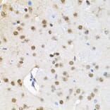 Immunohistochemistry - Anti-SMARCD1 Antibody (A16381) - Antibodies.com
