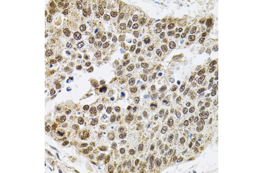 Immunohistochemistry - Anti-SMARCD1 Antibody (A16381) - Antibodies.com