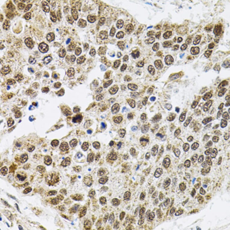 Immunohistochemistry - Anti-SMARCD1 Antibody (A16381) - Antibodies.com