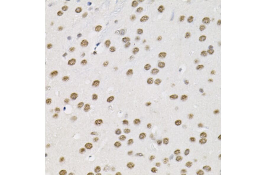 Immunohistochemistry - Anti-SMARCD1 Antibody (A16381) - Antibodies.com