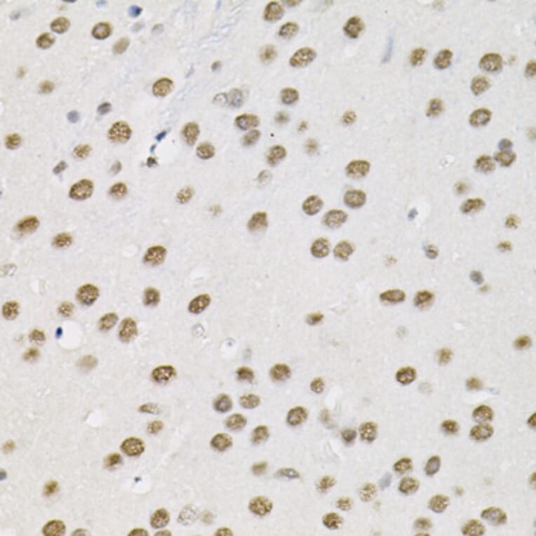 Immunohistochemistry - Anti-SMARCD1 Antibody (A16381) - Antibodies.com