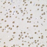 Immunohistochemistry - Anti-SMARCD1 Antibody (A16381) - Antibodies.com
