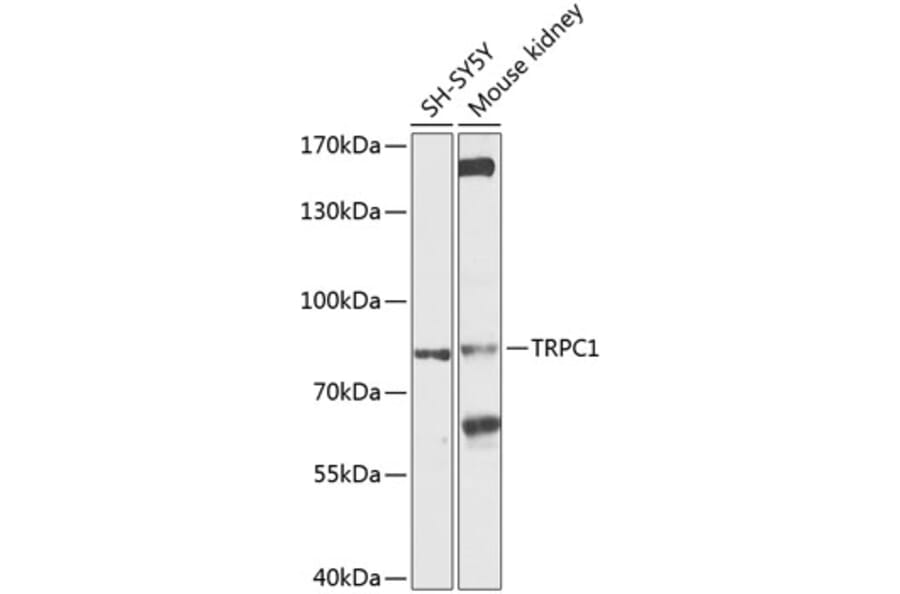 Western Blot - Anti-TRPC1 Antibody (A9952) - Antibodies.com
