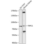 Western Blot - Anti-TRPC1 Antibody (A9952) - Antibodies.com