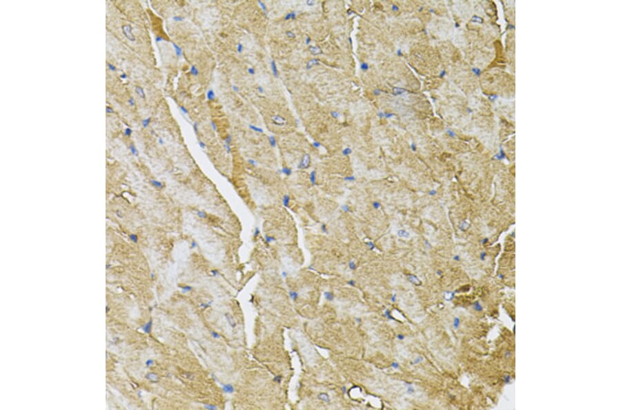 Immunohistochemistry - Anti-TRPC1 Antibody (A9952) - Antibodies.com