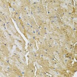 Immunohistochemistry - Anti-TRPC1 Antibody (A9952) - Antibodies.com