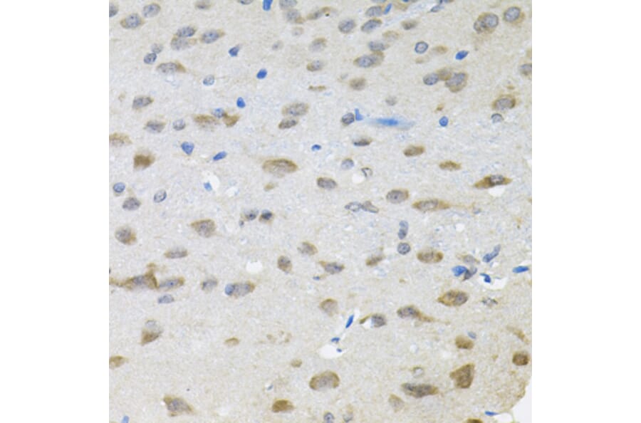 Immunohistochemistry - Anti-TRPC1 Antibody (A9952) - Antibodies.com
