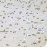 Immunohistochemistry - Anti-TRPC1 Antibody (A9952) - Antibodies.com