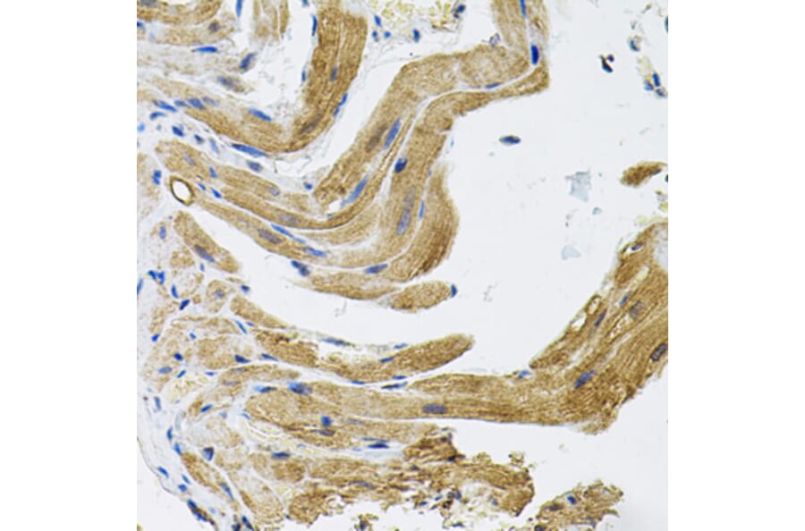 Immunohistochemistry - Anti-TRPC1 Antibody (A9952) - Antibodies.com