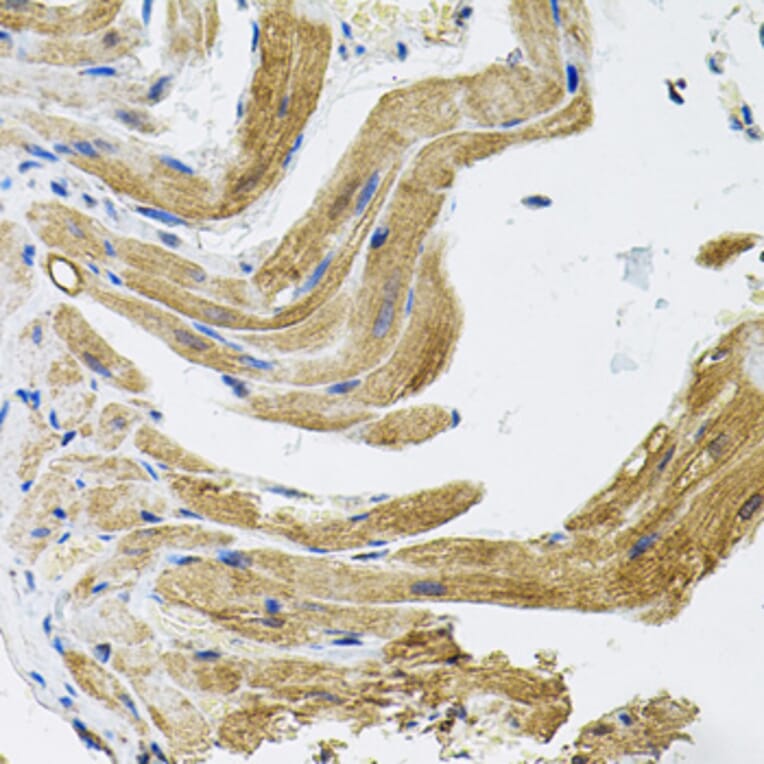 Immunohistochemistry - Anti-TRPC1 Antibody (A9952) - Antibodies.com
