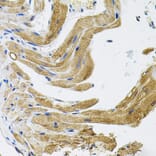 Immunohistochemistry - Anti-TRPC1 Antibody (A9952) - Antibodies.com