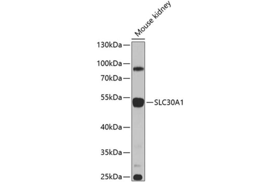 Western Blot - Anti-ZnT1 Antibody (A16383) - Antibodies.com
