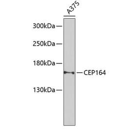 Western Blot - Anti-CEP164 Antibody (A16384) - Antibodies.com