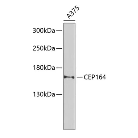 Western Blot - Anti-CEP164 Antibody (A16384) - Antibodies.com